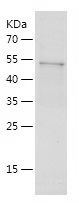    LPL / Recombinant Human LPL