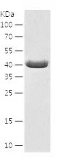    CALCOCO2 / Recombinant Human CALCOCO2