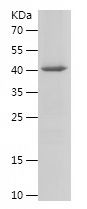    TRIM25 / Recombinant Human TRIM25