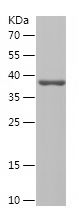    USP5 / Recombinant Human USP5