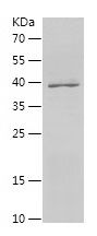    TAP1 / Recombinant Human TAP1