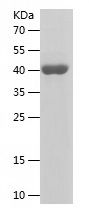    CIB1 / Recombinant Human CIB1