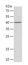    KLHL3 / Recombinant Human KLHL3