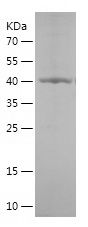    RICTOR / Recombinant Human RICTOR