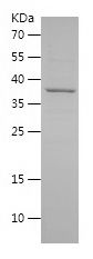    HNRNPA1 / Recombinant Human HNRNPA1