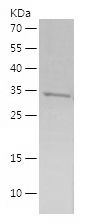    SPTLC2 / Recombinant Human SPTLC2