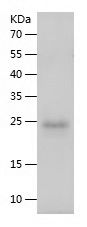 Recombinant Rabbit TIMP1