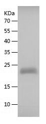    Timp-2 / Recombinant Human Timp-2