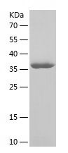    APLNR / Recombinant Human APLNR