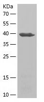    SNAP29 / Recombinant Human SNAP29