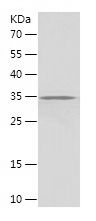    ZRANB3 / Recombinant Human ZRANB3