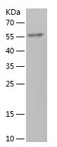    ATF6B / Recombinant Human ATF6B