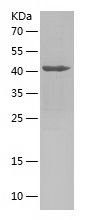    PDLIM7 / Recombinant Human PDLIM7