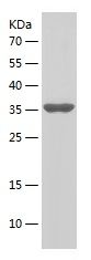    VDAC2 / Recombinant Human VDAC2