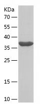    CCT3 / Recombinant Human CCT3