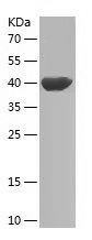    RPAP2 / Recombinant Human RPAP2