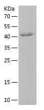    LPCAT1 / Recombinant Human LPCAT1