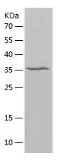    COQ10A / Recombinant Human COQ10A