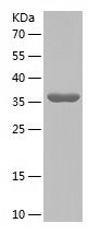    STK4 / Recombinant Human STK4