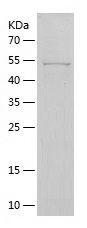    TFPI / Recombinant Human TFPI