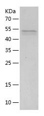    SFRP1 / Recombinant Human SFRP1