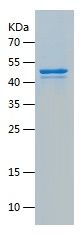    GLUD1 / Recombinant Human GLUD1