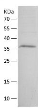    SLC5A5 / Recombinant Human SLC5A5