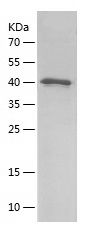    RPGRIP1L / Recombinant Human RPGRIP1L