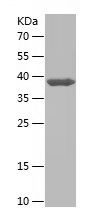    CYP11B2 / Recombinant Human CYP11B2