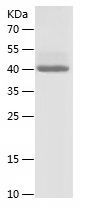    CD271 / Recombinant Human CD271