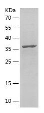    KIF15 / Recombinant Human KIF15