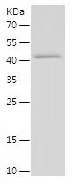    HEPACAM / Recombinant Human HEPACAM