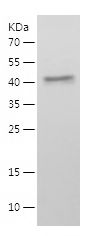    RAB7A / Recombinant Human RAB7A