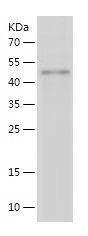    FHL3 / Recombinant Human FHL3