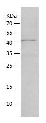    ACSL5 / Recombinant Human ACSL5