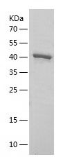    PYC / Recombinant Human PYC