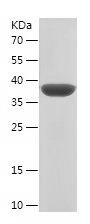    CETN1 / Recombinant Human CETN1