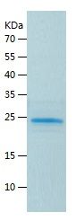    LIN28A / Recombinant Human LIN28A