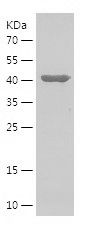    PARK7 / Recombinant Human PARK7