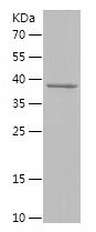    TUT4 / Recombinant Human TUT4