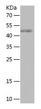    RARG / Recombinant Human RARG