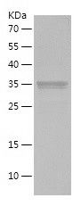    OXA1L / Recombinant Human OXA1L