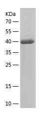    ARL4C / Recombinant Human ARL4C