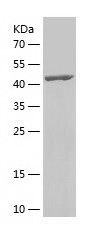    SEPTIN6 / Recombinant Human SEPTIN6