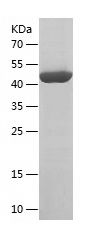    MAD2L2 / Recombinant Human MAD2L2