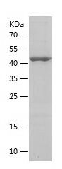    OAS2 / Recombinant Human OAS2