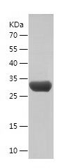    CEP290 / Recombinant Human CEP290