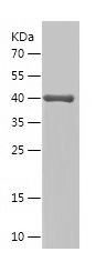    RYR2 / Recombinant Human RYR2