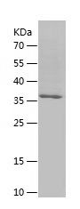    ATP6V0D1 / Recombinant Human ATP6V0D1