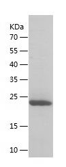    TNFAIP8 / Recombinant Human TNFAIP8